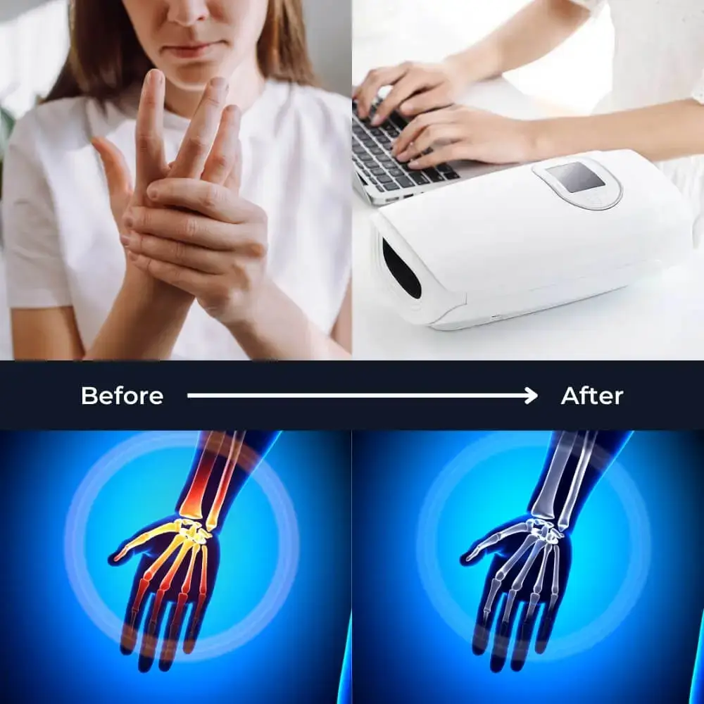 Before and after results of using the Hand Heat Massager